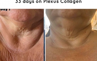 Plexus Collagen